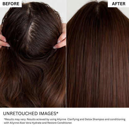 Ailynné Clarifying & Detox Shampoo For Oily Hair & Build Up - 200 ml