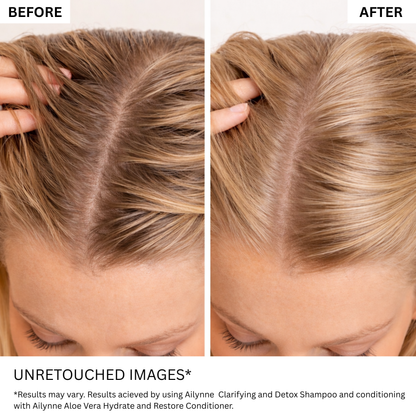 Ailynné Clarifying & Detox Shampoo For Oily Hair & Build Up - 200 ml