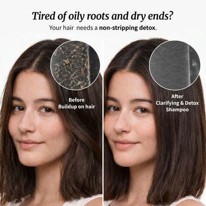 Ailynné Clarifying & Detox Shampoo For Oily Hair & Build Up - 200 ml